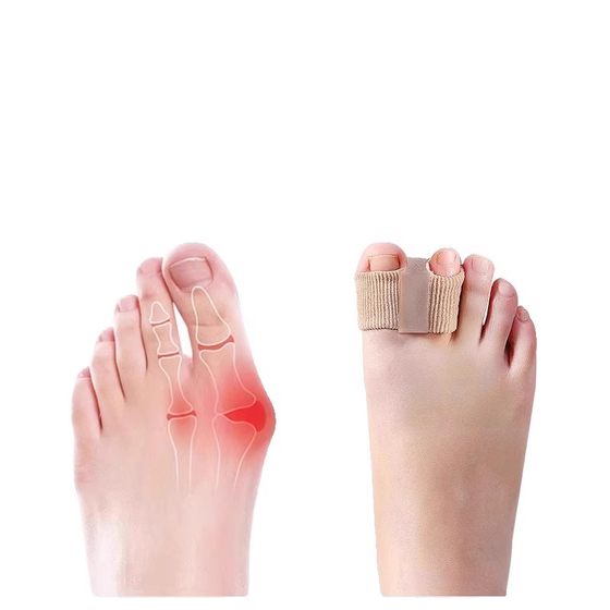 독일 엄지 밸브 컬 보정 발가락 발가락 스플리터 큰 발가락 정류기 엄지 밸브 컬 보정 발가락 스플리터 독일 엄지 밸브 컬 보정 발가락 발가락 스플리터 큰 발가락 정류기 엄지 밸브 컬 보정 발가락 스플리터