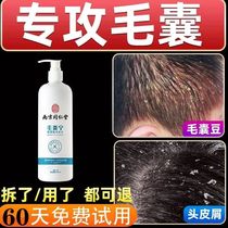 防脱发洗发水头皮毛囊琰去屑止痒控油蓬松去螨虫除螨头皮屑清洁液