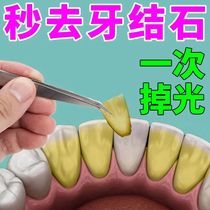 Dental plaque toothpaste (easily exfoliation) dental yellow stones clear dental plaque Tea stains Smoke Stains for dental cleaners