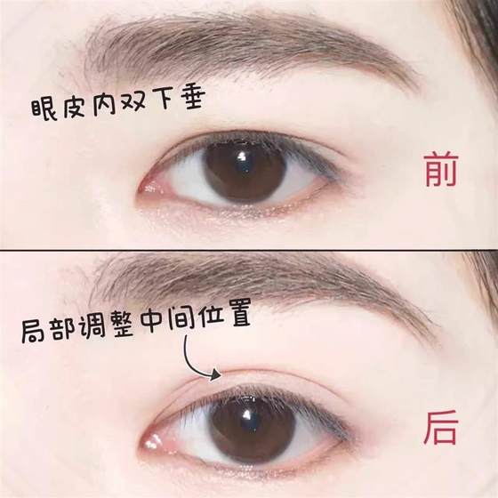 아이 테일 방지 레이스 보이지 않는 자연 트레이스리스 지원 강력한 접착제 프리 아이 테일 방지 레이스 보이지 않는 자연 트레이스리스 지원 강력한 접착제 프리