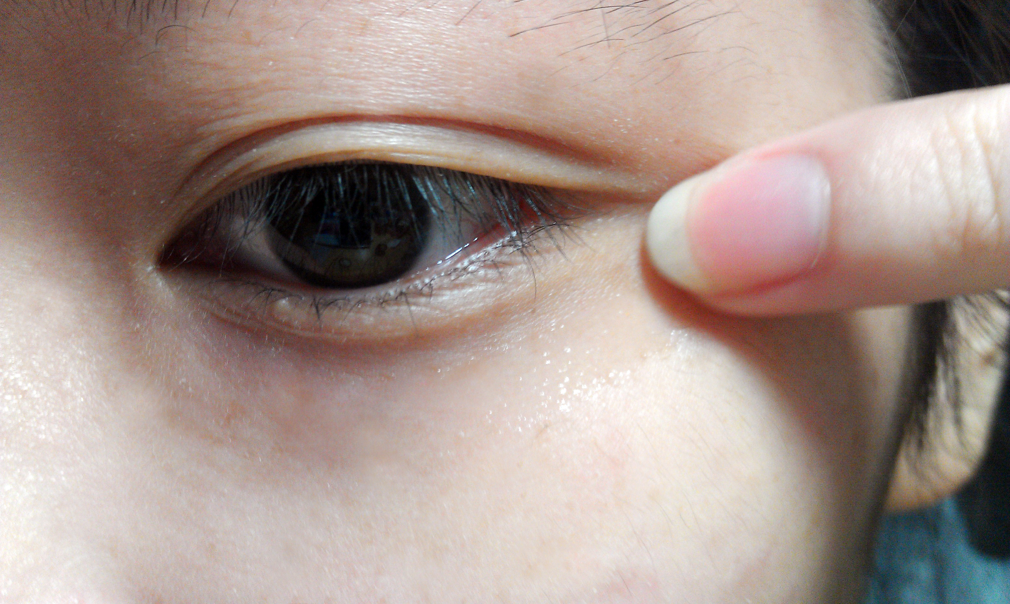 暴露年龄的鱼眼纹,这样护理更快消退