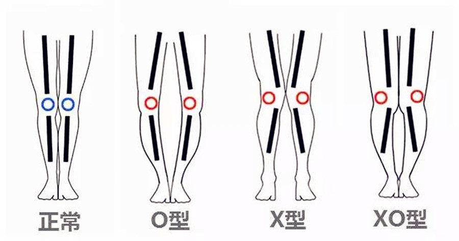 自查自己腿型,男人须知按腿型选裤子