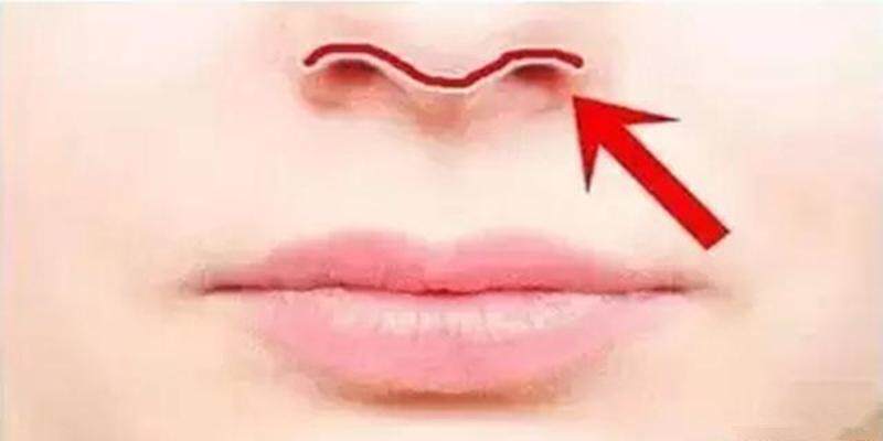 上缘到鼻头和海鸥线的鼻中柱大约为1:1;从侧面看,鼻唇角约为95—110度