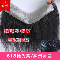 Mens and womens hairline wigs attached forehead hair patch Bangs Full real hair High head hair repair incognito invisible hair block