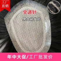 Full-handed needle-to-edge wig Custom male short hair scalp real hair Head hair replacement Natural realistic bald wig