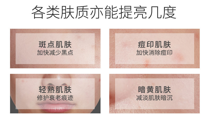 naco377安瓶熊果苷面部小送精华液介绍