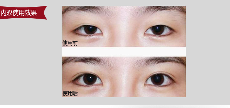 展示与对比:双眼皮贴隐形胶带卷 大弯剪美容剪刀 自然肤色肉色美目贴