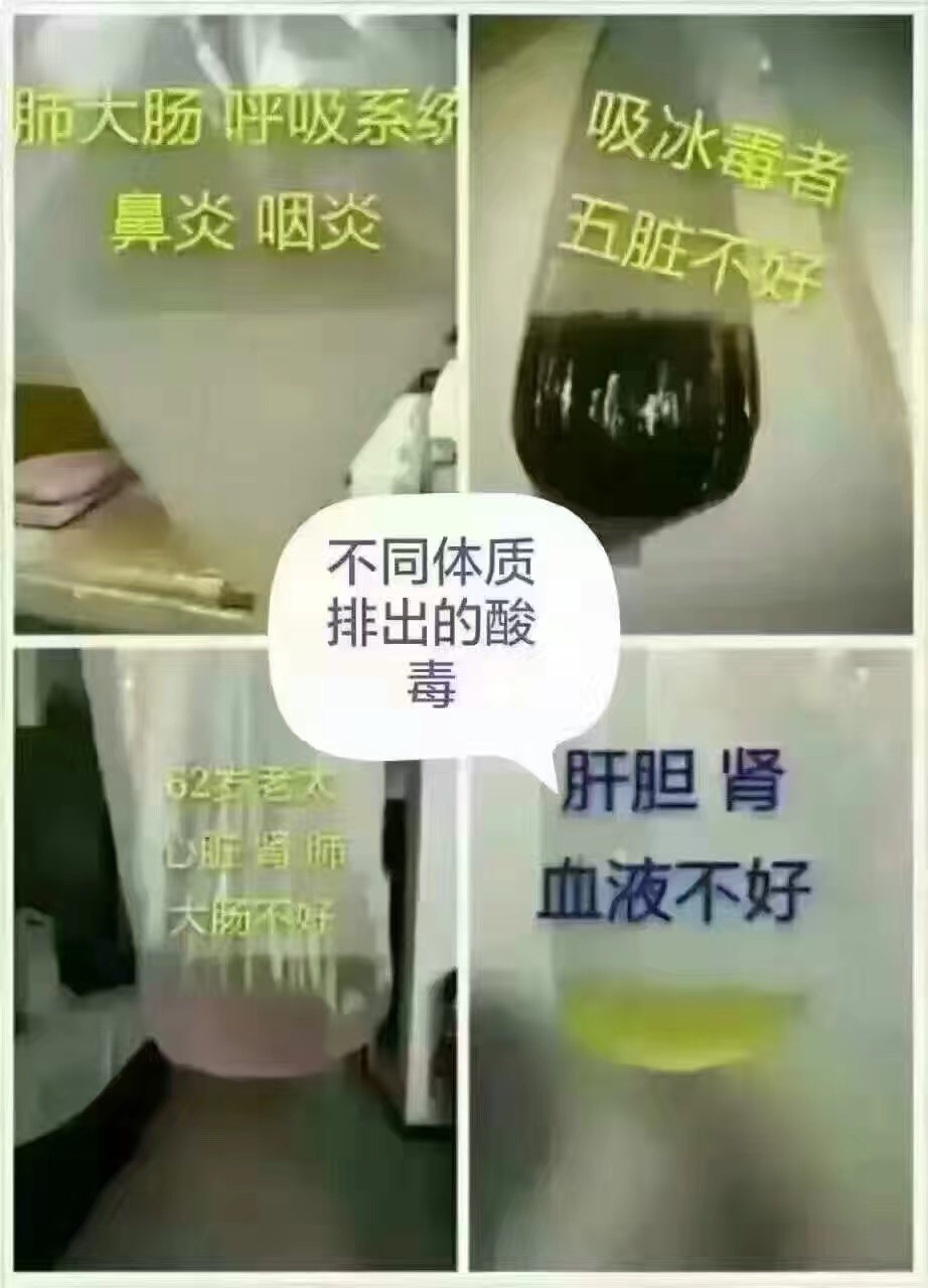 美容院装沙棘排酸套盒沙棘排酸膏按摩油液能量膏油排湿寒汗蒸毯