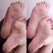 Little Red Riding Book Recommend Crapped Hands and Feet to Restore Moisturizing Today's Special Price 29 yuan One Bottle Buy Two Get One Free