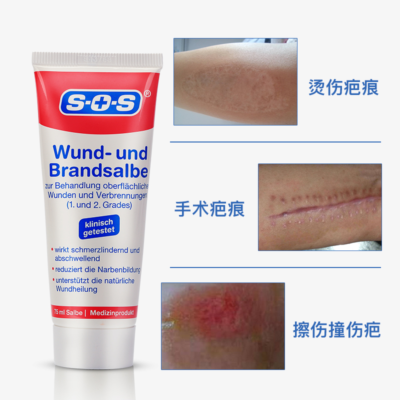 德国sos疤痕祛疤膏修复手术剖腹产去除伤疤凹凸淡化疤痕增生4支装