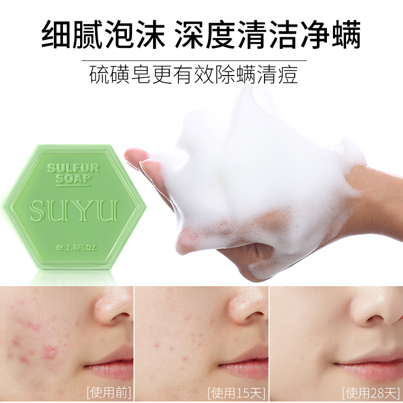 remove mites wash face sulfur sea salt soap horse oil facial soap sulfur deep cleaning female and male mites