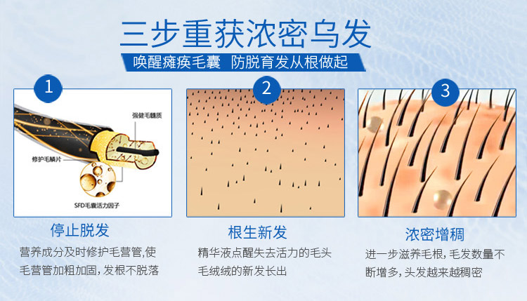 【长发神器】头发长得快变密3-5倍自然生长速
