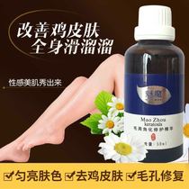 Succubus Hair Keratinization Repair Essence Exfoliates Chicken Skin Hair Follicles Keratinized Pimples Thighs Keratinized whole body Legs