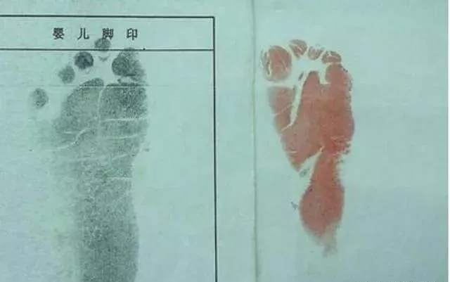 宝宝出生为啥留脚印?医生不说你也得知道