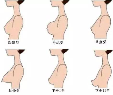 根据胸型选内衣,穿了这么多年挑对了吗?
