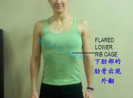 百分之五十的人都有肋骨外翻,看你中招了没