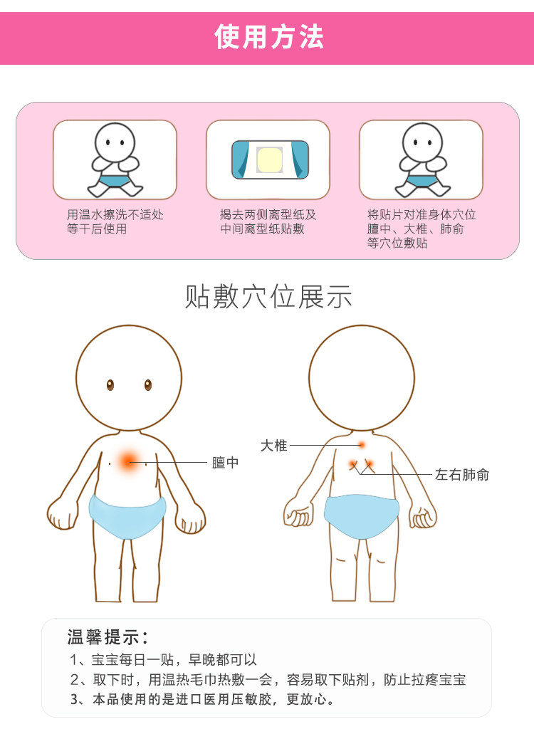 灸灸不忘宝宝贴止咳咳喘贴婴幼儿宝宝咳嗽贴儿童咳喘化痰平咳止咳