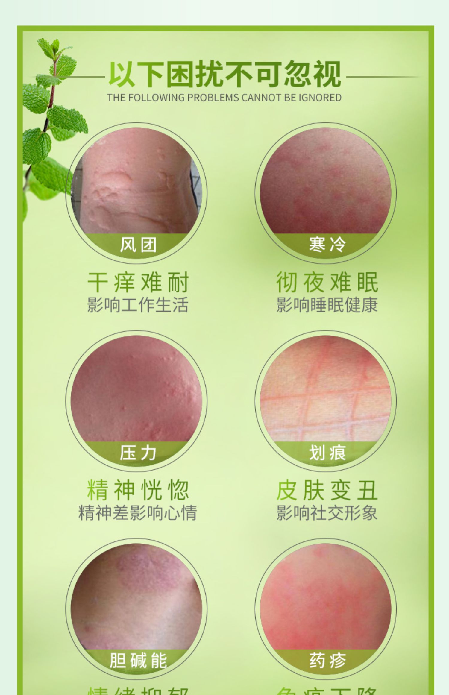 麻拯消风团疹膏皮肤过敏止痒