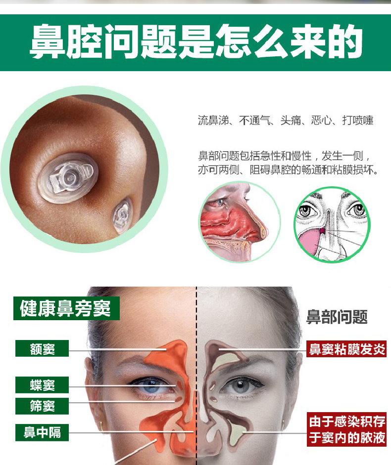 鼻炎药喷剂 洗鼻神器