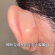 엘프 귀 패치 실리콘 보이지 않는 피부 색 칩 무광택 통증없이 강력한 지지대 수직 귀 장치를 보여주는 수직 귀 장치를 세척 할 수 있습니다. 엘프 귀 패치 실리콘 보이지 않는 피부 색 칩 무광택 통증없이 강력한 지지대 수직 귀 장치를 보여주는 수직 귀 장치를 세척 할 수 있습니다.