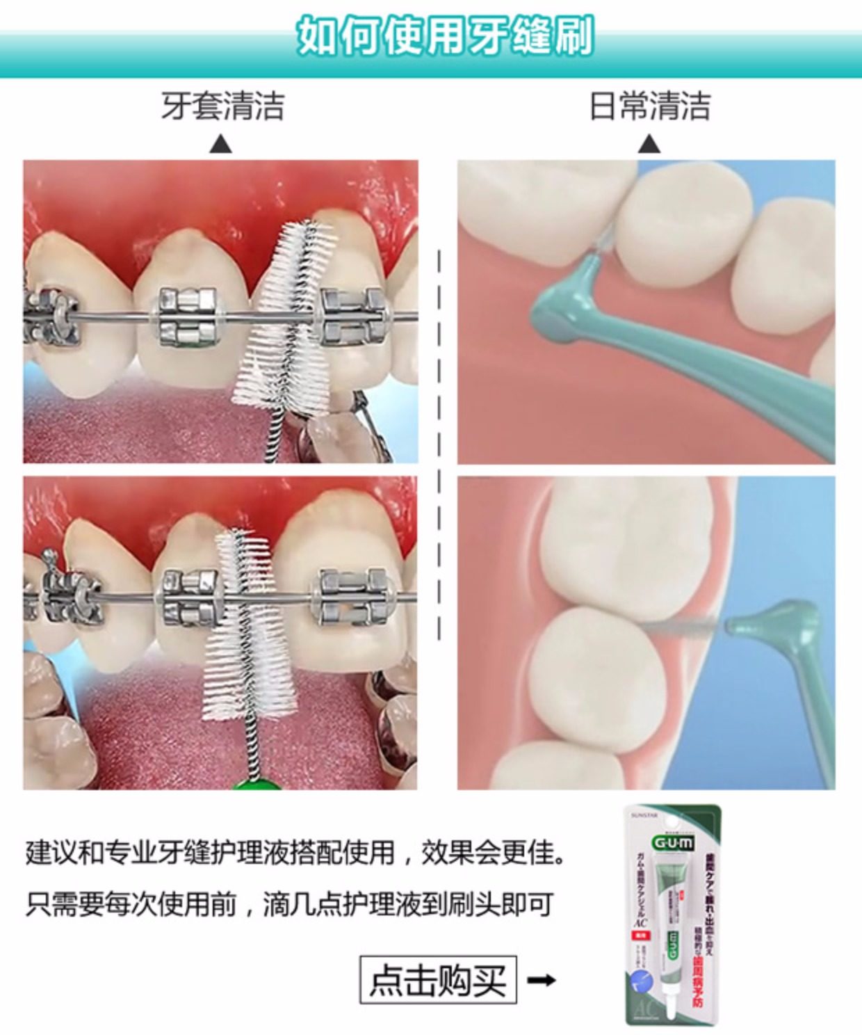 日本进口gum牙缝刷l型牙间刷正畸软毛牙周护理牙套专用牙刷齿缝刷
