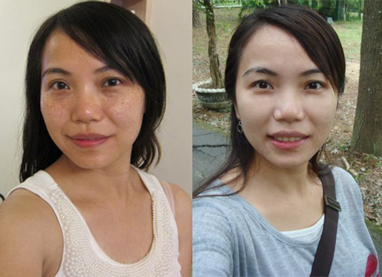 正品 汴禧d女郎 美白祛斑套盒 改善暗黄淡化斑点提亮肤色 特价包邮