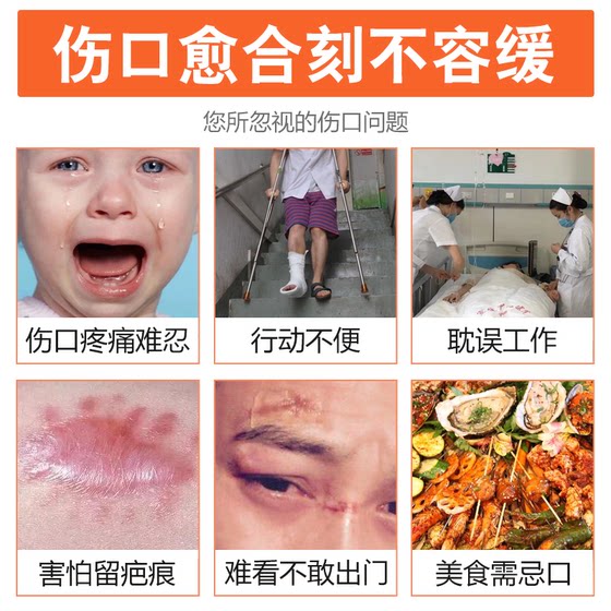 당뇨병 발 썩은 발면 나쁜 발 상처는 오래된 다리의 상처에 고름을 치유 할 수 없습니다. 당뇨병 발 썩은 발면 나쁜 발 상처는 오래된 다리의 상처에 고름을 치유 할 수 없습니다.