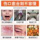 당뇨병 발 썩은 발면 나쁜 발 상처는 오래된 다리의 상처에 고름을 치유 할 수 없습니다. 당뇨병 발 썩은 발면 나쁜 발 상처는 오래된 다리의 상처에 고름을 치유 할 수 없습니다.