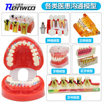 Dental model dental teaching model dental implant dental preparation orthodontic pathology oral model