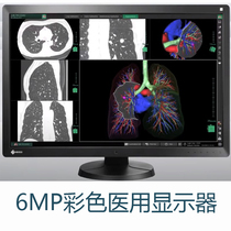 Yijo) Global Brand 8MP Color Medical Display EV3285 3840X2160 Arbitrary 4 images