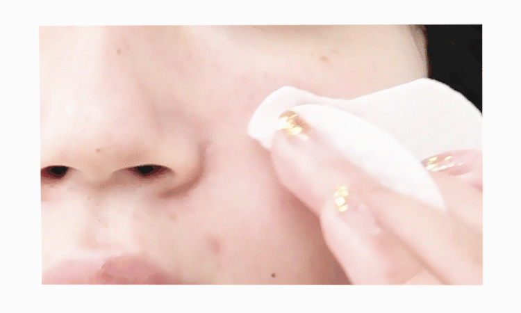 unny水杨酸棉片果酸刷酸去闭口黑头粉刺祛痘痘印收缩毛孔清洁贴片_全