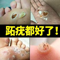 Plantar wart virus wart flesh thorn wart thorn monkey stop you you you you you you you you you you you you you you you you you