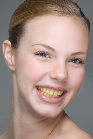 这样的人笑起来要人命,千万别这样