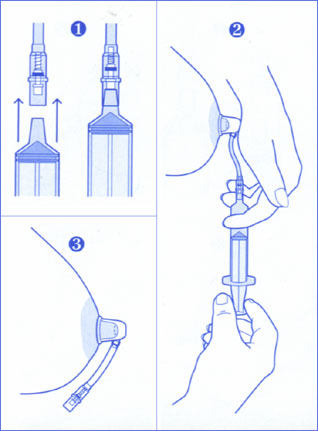 Ниппельная присоска 