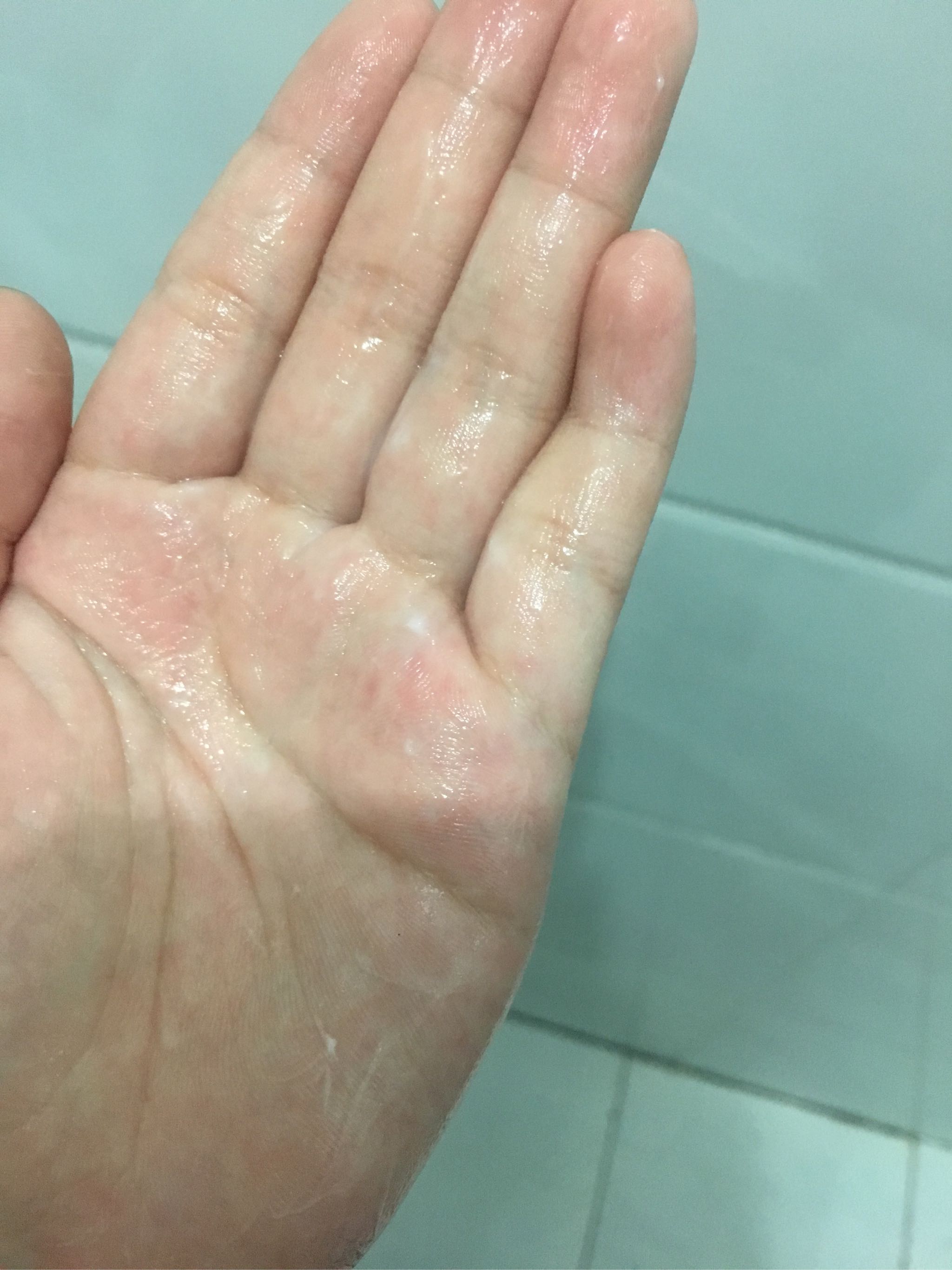 医用级壳聚糖护肤品新宠质量怎么样一个多少钱,宝妈的亲自使用感受(价格实惠),第9张 医用级壳聚糖护肤品新宠质量怎么样一个多少钱,宝妈的亲自使用感受(价格实惠),第9张