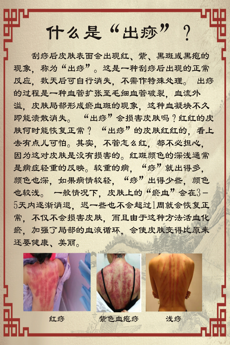 刮痧的作用刮痧对身体有什么好处