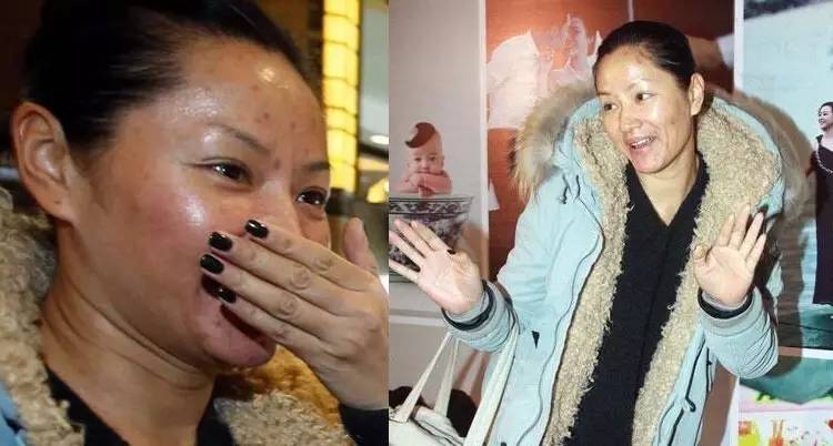 女明星烂脸照曝光,倪妮排第二而第一竟是