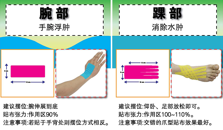 肌效贴的常用方法