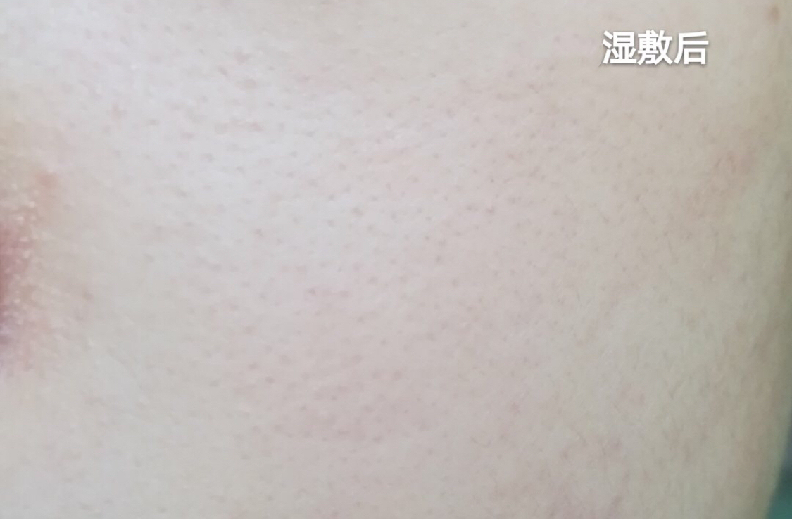 收缩毛孔#宿系之源马鞭草酮迷迭香纯露