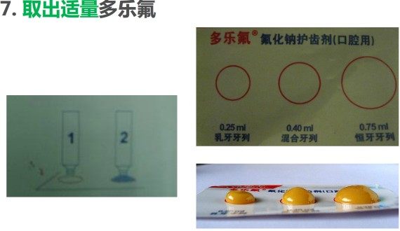 2021进口高露洁多乐氟duraphat氟化钠护齿涂氟剂蛀牙脱矿儿童成人