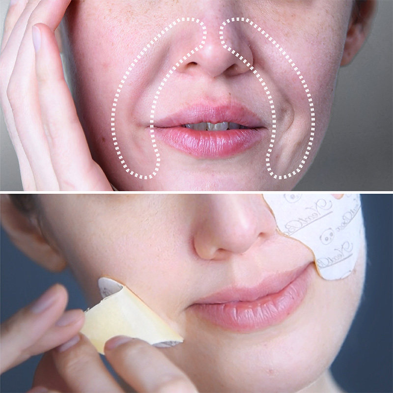 魔盒法令纹修护贴铁盒装 改善嘴角细纹八字表情纹修护提拉紧致