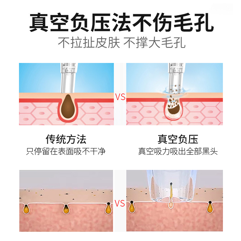 blahead suction device electric blahead suction artifact for men and women