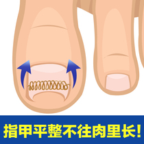 Nail groove embedded nail corrector wire nail patch Nail patch Pedicure nail clipper set pedicure knife Nail tool nail inflammation