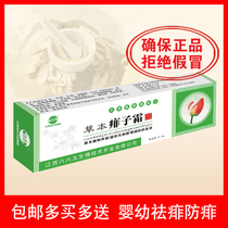 Herb prickly heat cream baby to raspy heat rasping powder Dew baby rasping cream Yi Fubao 865