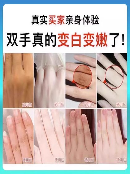 할머니의 손은 소녀의 손으로 변하고 섬세한 손을줍니다. 밥솥의 손에 작별 인사를하십시오. 2 개의 무료 1 ~ 할머니의 손은 소녀의 손으로 변하고 섬세한 손을줍니다. 밥솥의 손에 작별 인사를하십시오. 2 개의 무료 1 ~