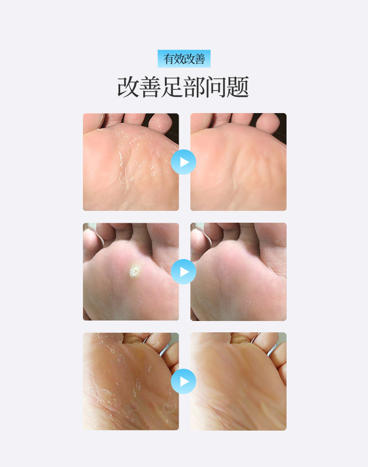 去老茧死皮修脚刀磨脚器脚搓脚板去角质刨脚刀刮脚刀修脚工具套装