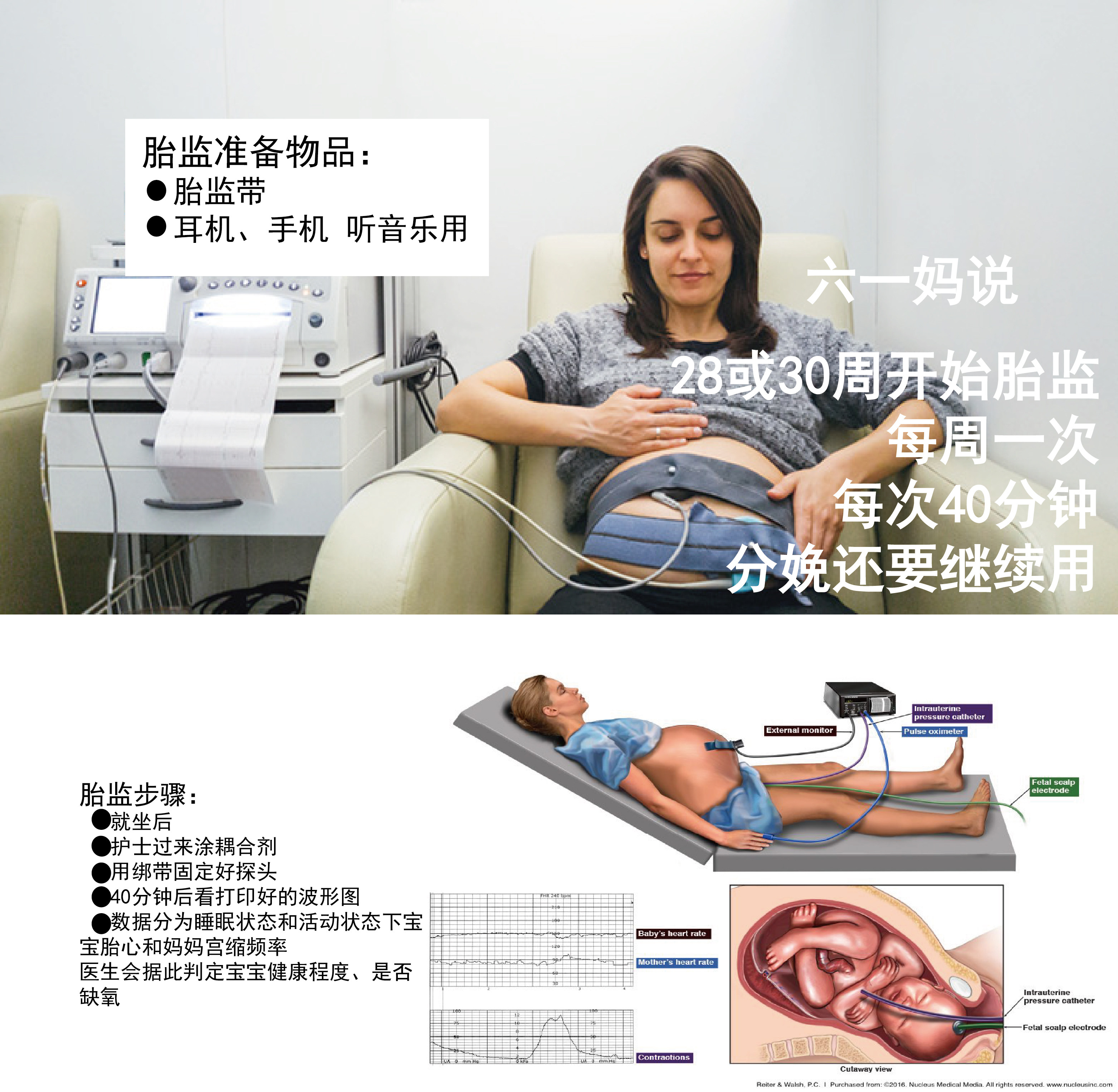 医院通用胎监带 产检用孕产妇胎心监护弹力绑带 六一家