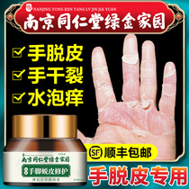 Hand peeling repair cream seasonal finger cracking Palm hand hand molting Skin Skin dry hand peeling