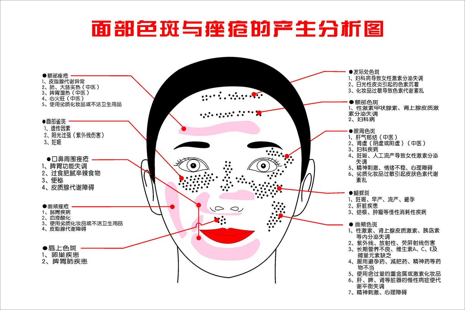 668海报印制展板素材959面部色斑与痤疮的产生分析图