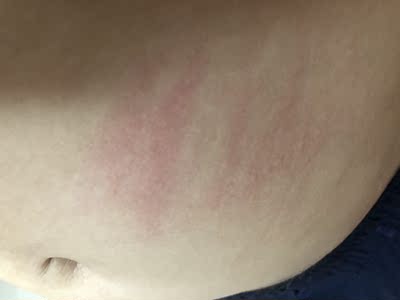 有刺激性，容易过敏，下次不会买了